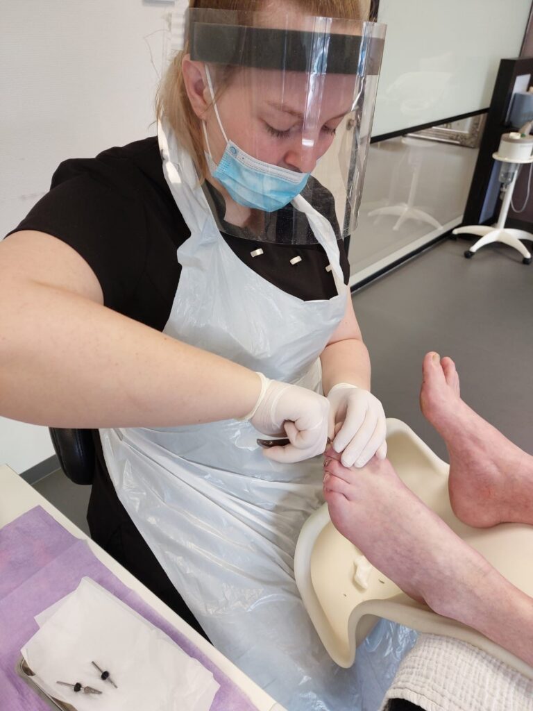 pedicure likdoorns