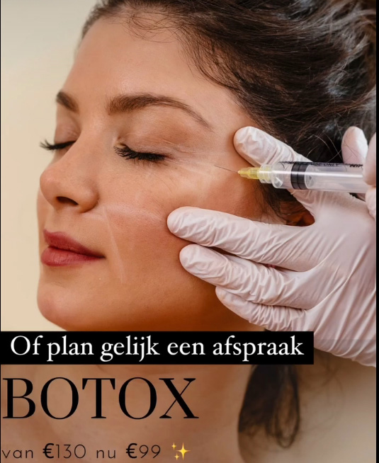 botox en fillers actie