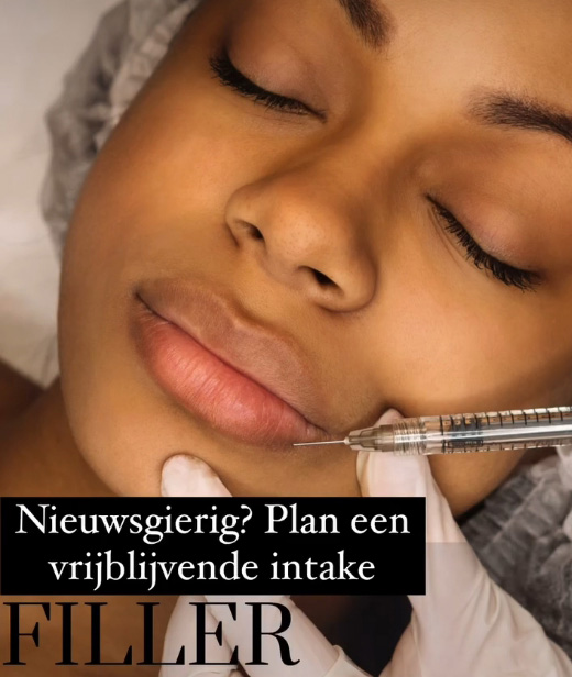 filler plan een intake