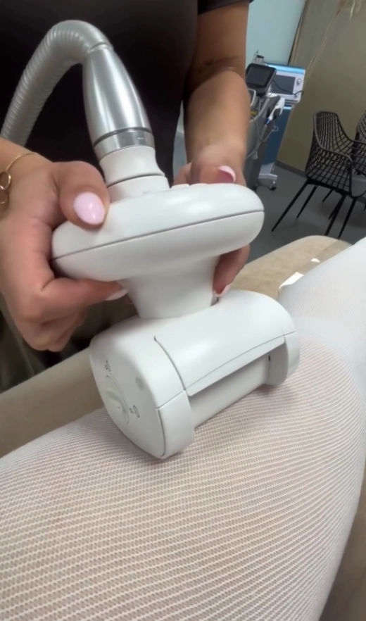 lpg endermologie behandeling
