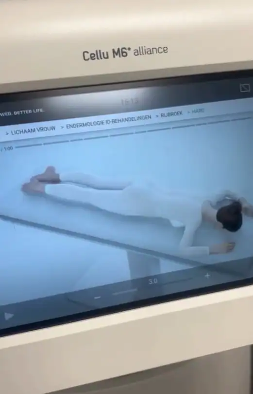 LPG endermologie apparaat van huidkliniek zaia