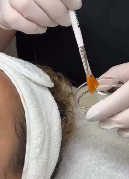 Glass skin behandeling bij huidkliniek zaia