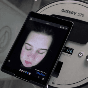 Observ 520 huidscan toont huidanalyse bij cliënt van Huidkliniek Zaia in Hoogezand
